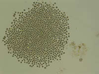 Image of microcystis