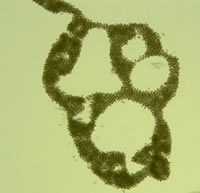 Image of mycrocystis